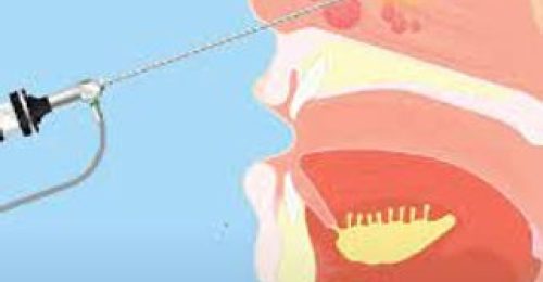 910504_6bcf39b662cf4103bd8b4fa2e