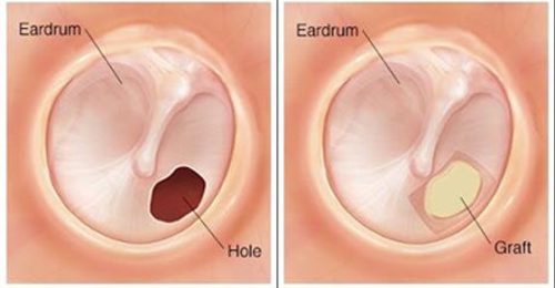 910504_6ff02c80ad354e98841cd04d5